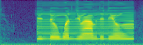 Electro-larynx Spectrogram